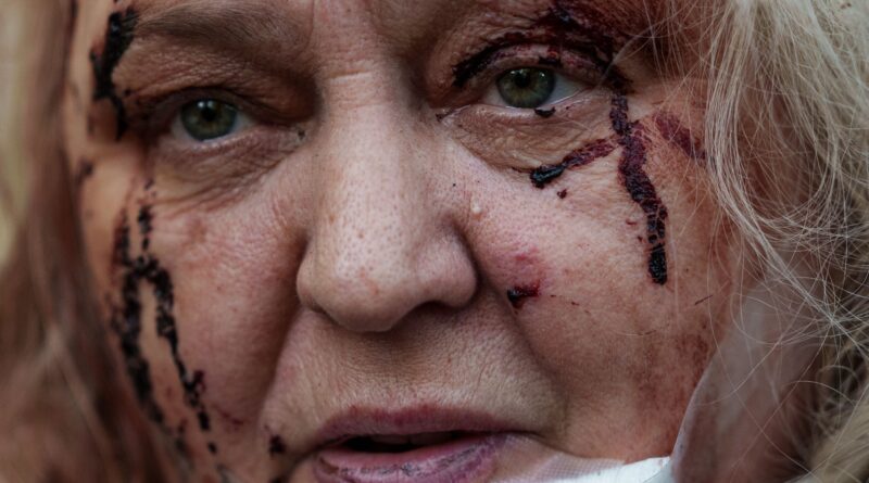 Close-up of a woman’s injured face with blood around the eye and cheek, wearing a white medical mask at the chin.
