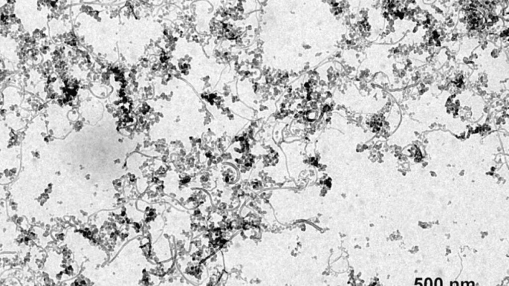 Transmission electron micrograph of tangled filamentous nanostructures with dark clusters; scale bar indicates 500 nm.